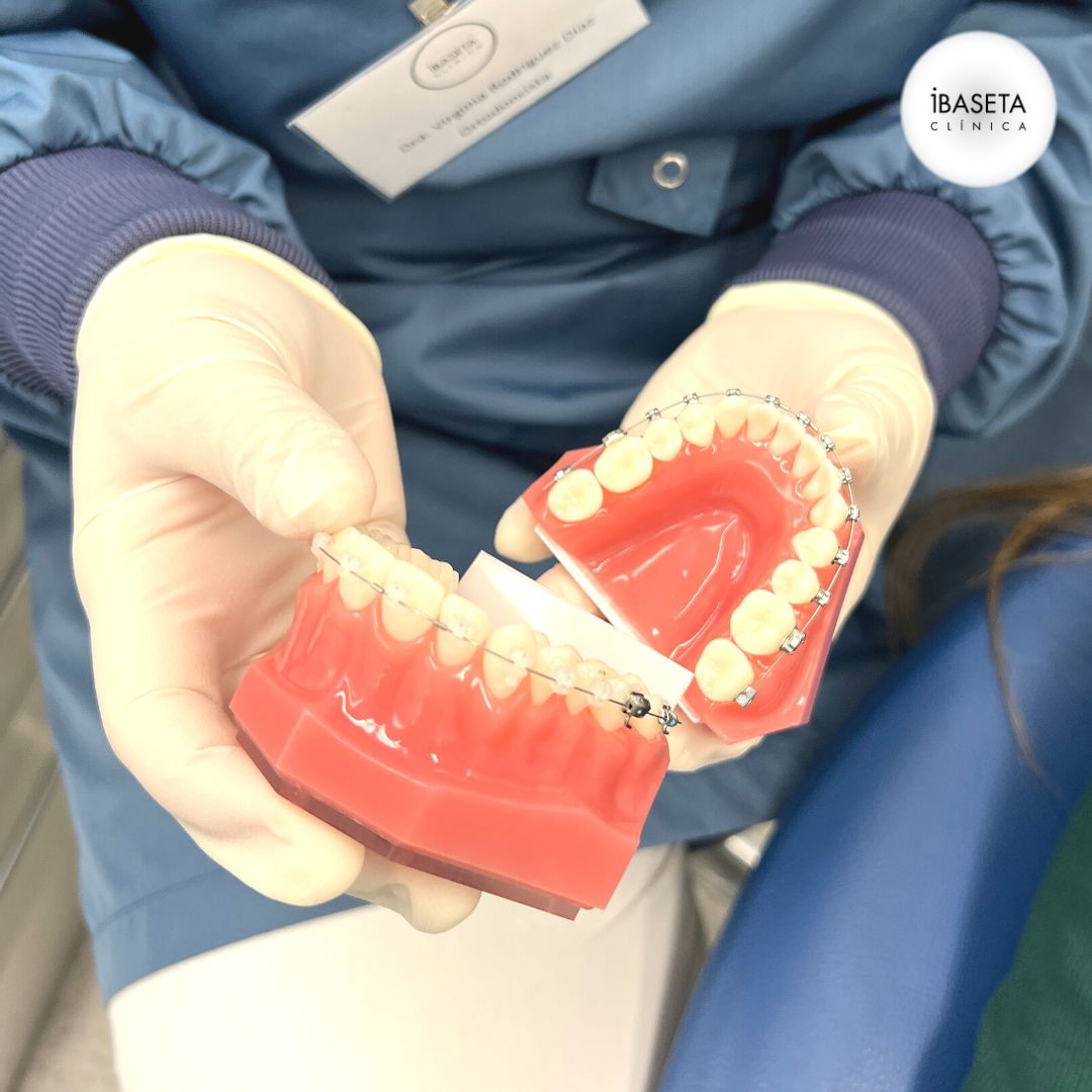 Día Mundial de la Ortodoncia: Sonrisas perfectas y su importancia en la Salud Bucodental
