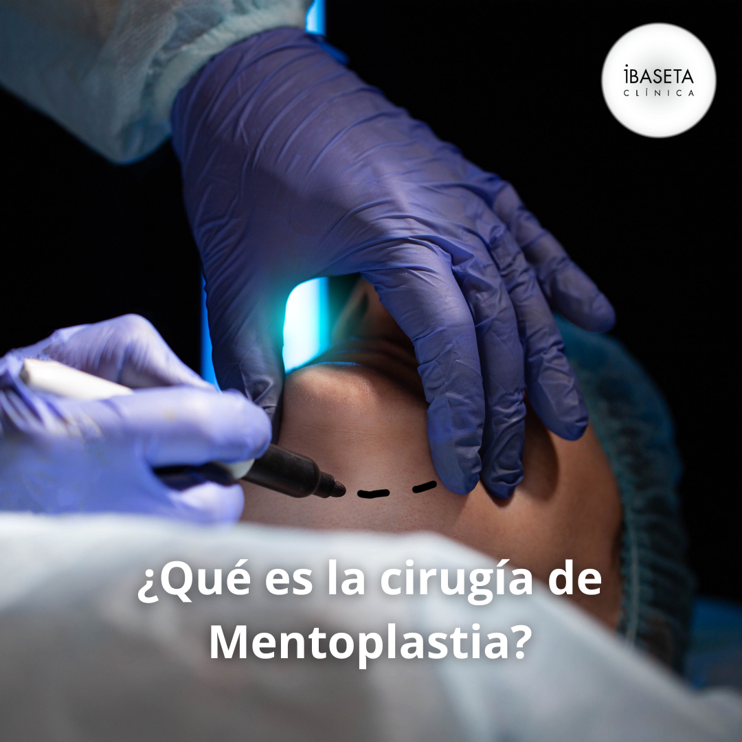 ¿Qué es la cirugía de mentoplastia?
